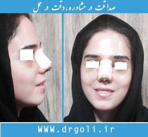 اقدامات قبل از عمل جراحی زیبایی بینی