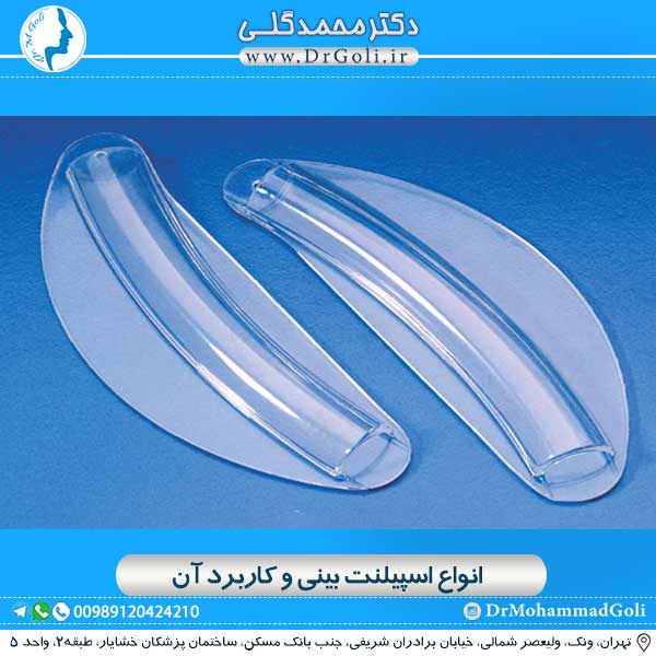اسپیلنت بینی بعد از عمل