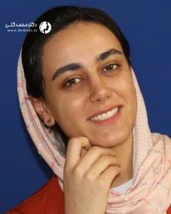 جراحی زیبایی بینی