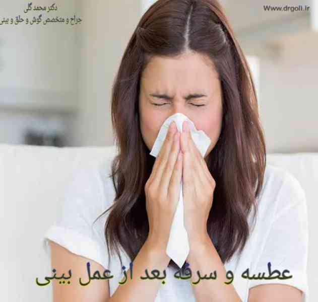 عطسه بعد عمل بینی - دکتر محمد گلی