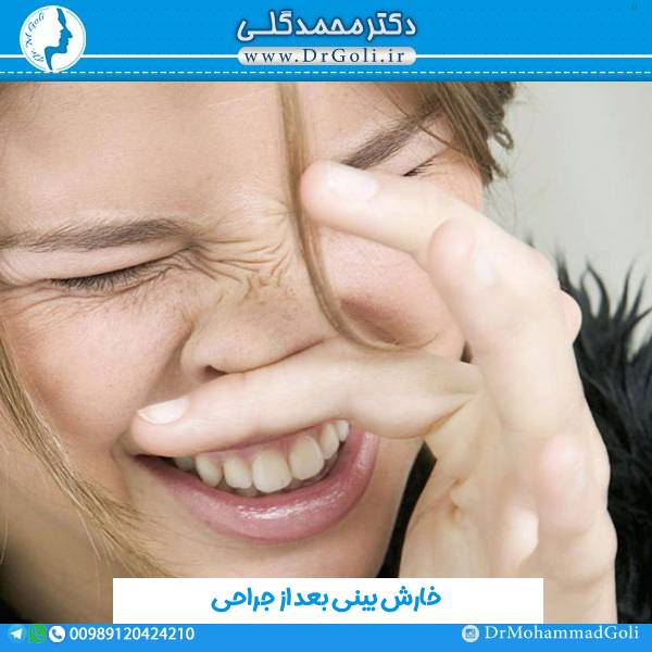 خارش بینی بعد از جراحی