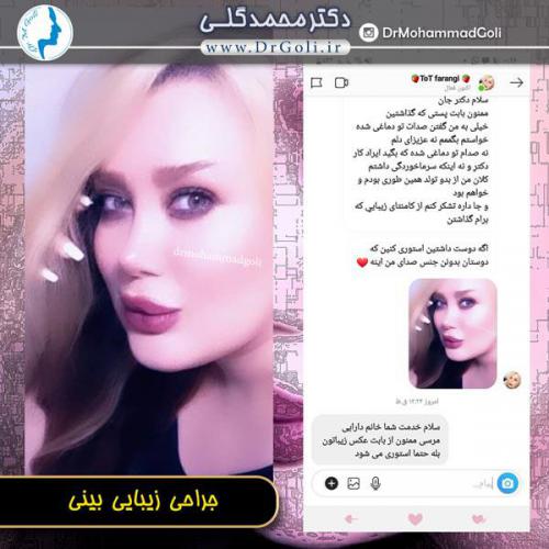 جراحی بینی 91