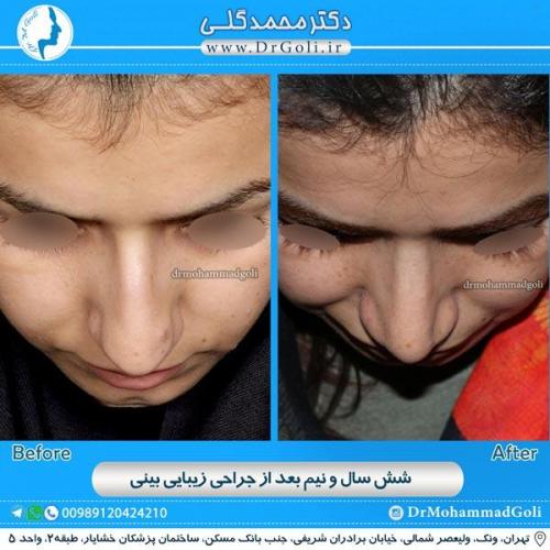 جراحی زیبایی بینی 123