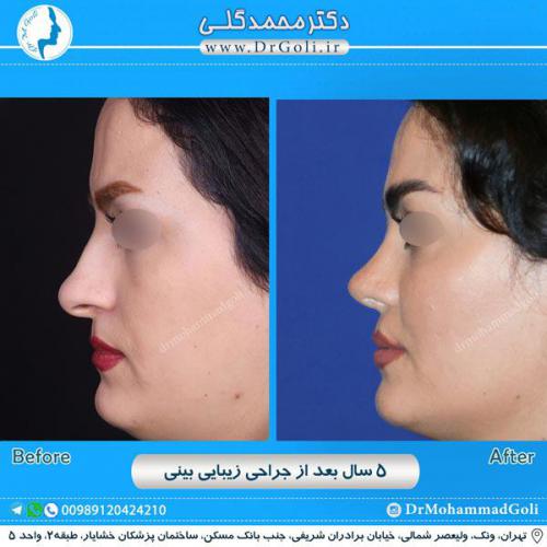 جراحی زیبایی بینی 247
